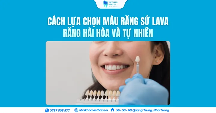 Cách lựa chọn màu răng sứ Lava răng hài hòa và tự nhiên