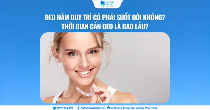 Đeo hàm duy trì có phải suốt đời không? Thời gian cần đeo là bao lâu?