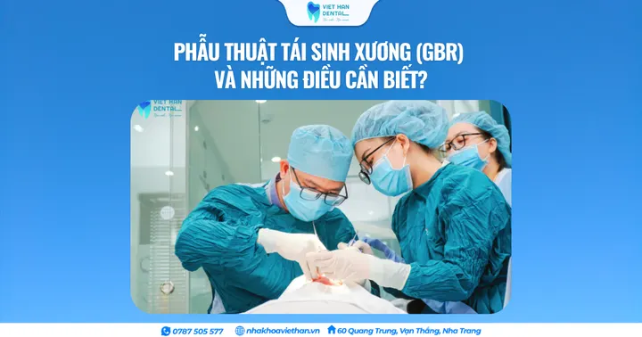 Phẫu thuật tái sinh xương (GBR) và những điều cần biết?