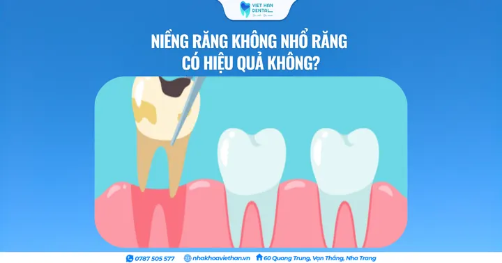 Niềng răng không cần nhổ răng có hiệu quả không?