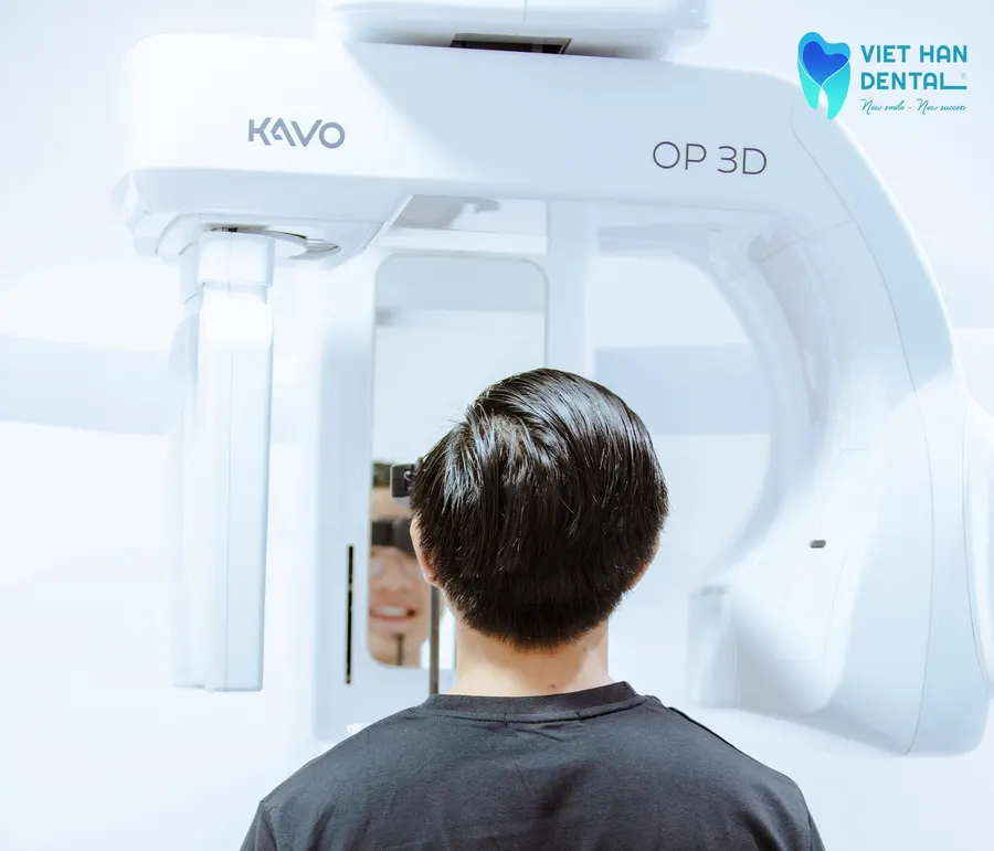 Chụp CT răng trước khi cấy ghép răng Implant 