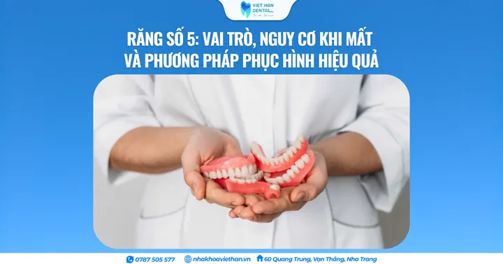 Răng số 5: Vai trò, nguy cơ khi mất và phương pháp phục hình hiệu quả