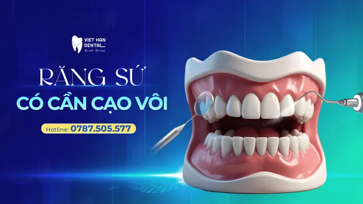 Bọc răng sứ có lấy cao răng được không?