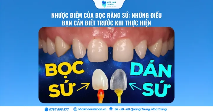 Nhược Điểm Của Bọc Răng Sứ: Những Điều Bạn Cần Biết Trước Khi Thực Hiện