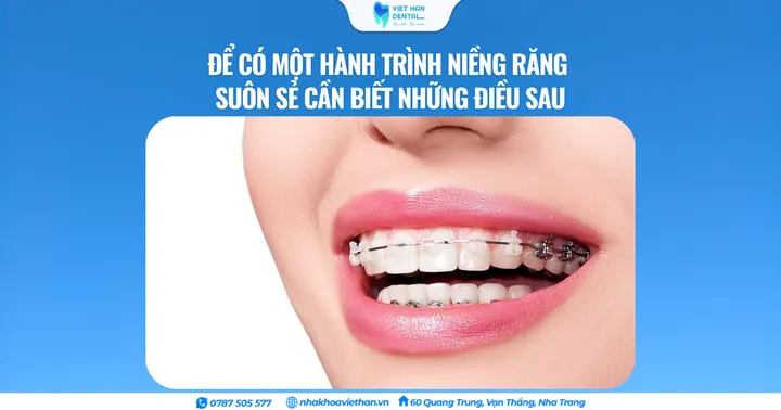 Để có một hành trình niềng răng suôn sẻ cần biết những điều sau