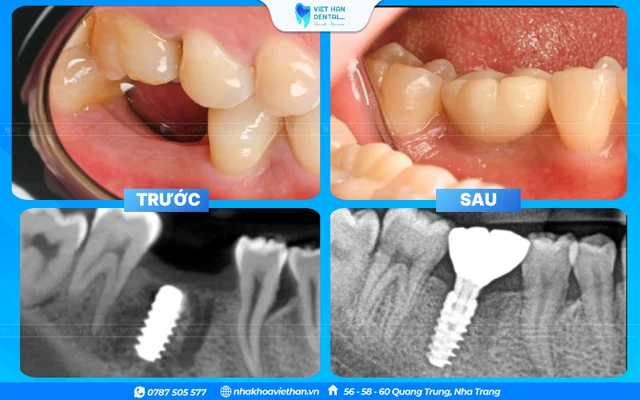 Hình ảnh khách hàng 3 của Bác sĩ Phạm Nhật Huy
