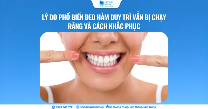 Lý do phổ biến đeo hàm duy trì vẫn bị chạy răng và cách khắc phục