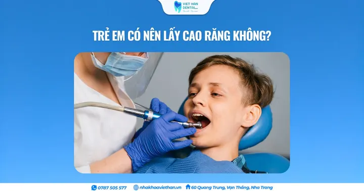 Trẻ em có nên lấy cao răng không?