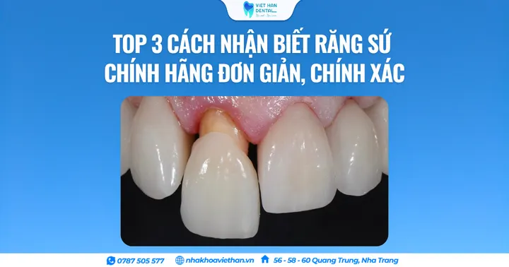 Top 3 cách nhận biết răng sứ chính hãng đơn giản, chính xác