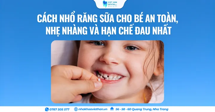 Cách nhổ răng sữa cho bé an toàn, nhẹ nhàng và hạn chế đau nhất