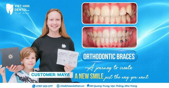 Invisalign for Teenagers – Maya’s 1-Year Journey to a Transformed Smile