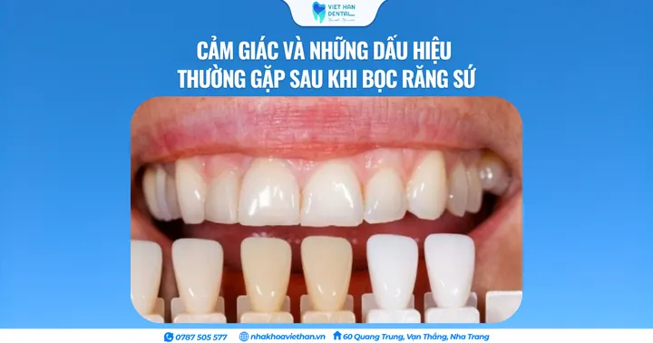Cảm giác và những biểu hiện thường gặp sau khi bọc răng sứ