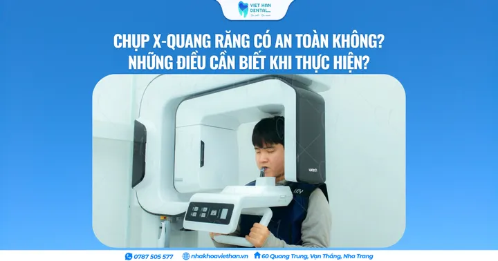 Chụp X-quang răng có an toàn không? Những điều cần biết khi thực hiện?