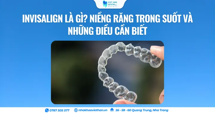 Invisalign là gì? Cẩm nang niềng răng trong suốt từ A đến Z