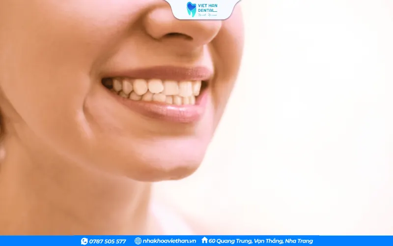 Phẫu thuật hàm là một phương pháp điều trị lệch hàm