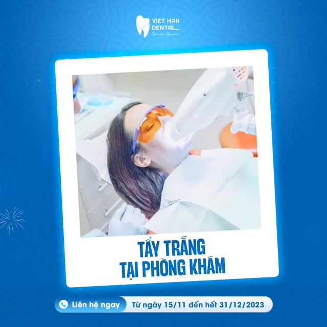 Tẩy trắng răng với công nghệ Laser Whitening (Trị giá 2.500.000)