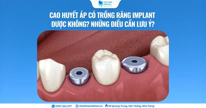 Cao huyết áp có trồng răng Implant được không? Những điều cần lưu ý?