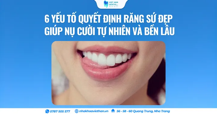 6 yếu tố quyết định răng sứ đẹp giúp nụ cười tự nhiên và bền lâu