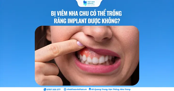 Bị viêm nha chu có thể trồng răng Implant được không?