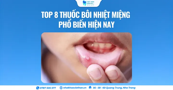 Top 8 thuốc bôi nhiệt miệng phổ biến hiện nay