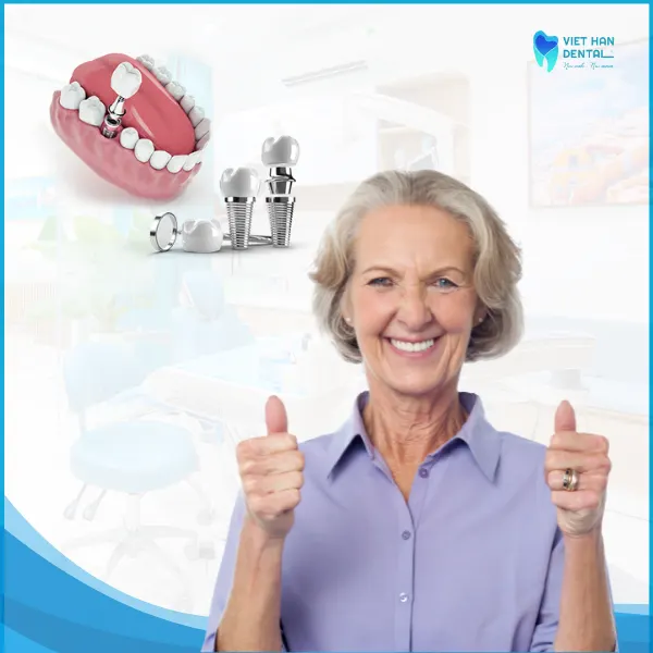 Thử và gắn răng sứ cố định trên Implant (Khoảng 60 phút)