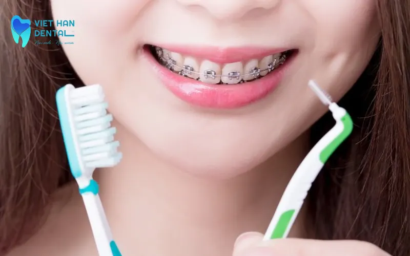 Careful oral hygiene during orthodontic treatment