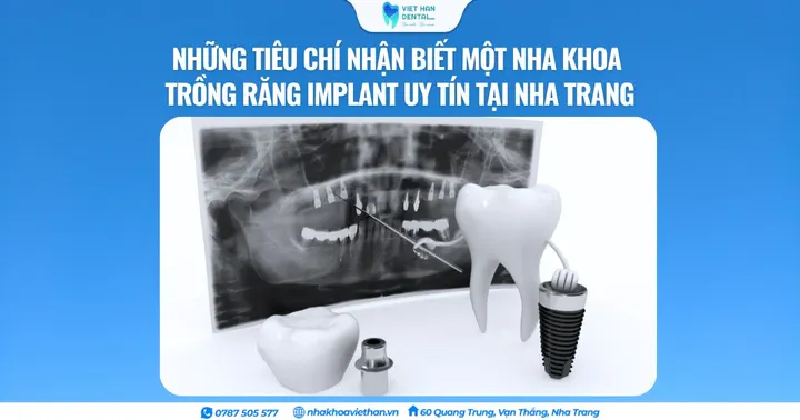 Những tiêu chí nhận biết một nha khoa trồng răng Implant uy tín tại Nha Trang