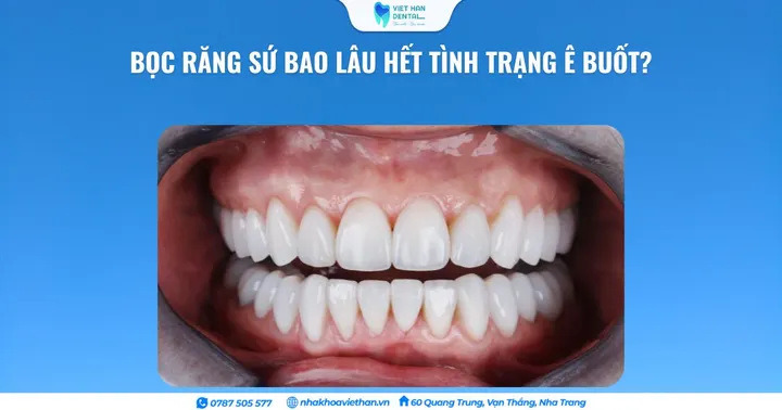 Bọc răng sứ bao lâu hết tình trạng ê buốt?