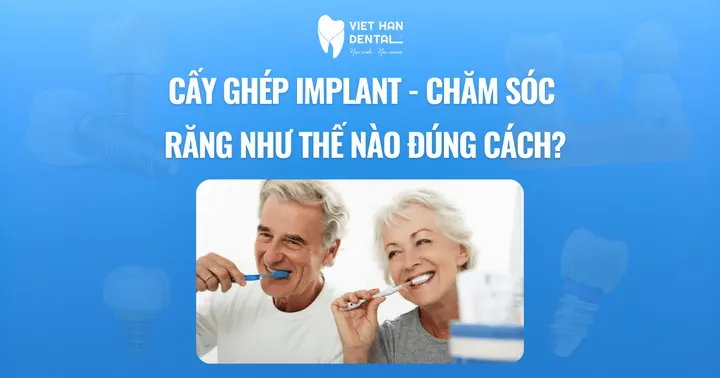Cấy ghép Implant chăm sóc răng như thế nào đúng cách?