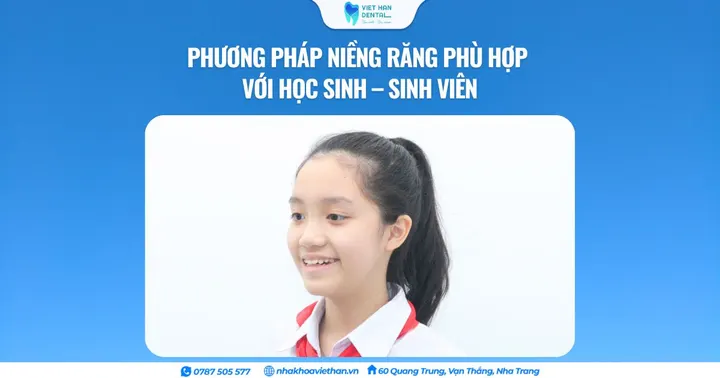 Phương pháp niềng răng phù hợp với học sinh – sinh viên
