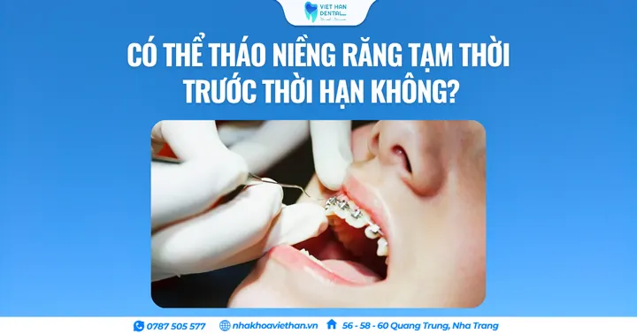 Có thể tháo niềng răng tạm thời trước thời hạn không?