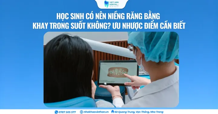 Học sinh có nên niềng răng bằng khay trong suốt không? Ưu nhược điểm cần biết