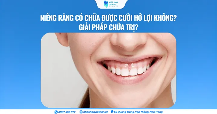 Niềng răng có chữa được cười hở lợi không? Giải pháp chữa trị?