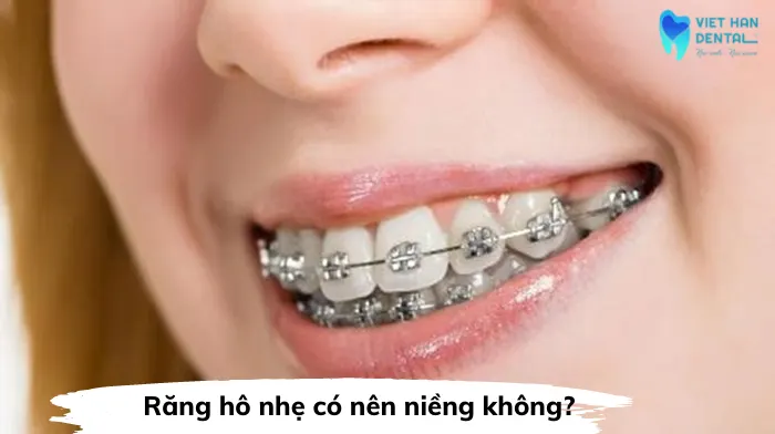 Rang Ho Nhe Co Nen Nieng Khong Nieng Rang Nha Trang 2