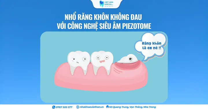 Nhổ răng khôn không đau với công nghệ siêu âm Piezotome