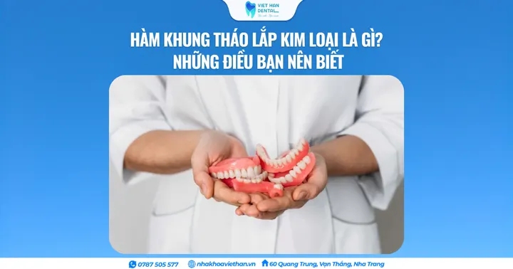 Hàm khung tháo lắp kim loại là gì? Những điều bạn nên biết