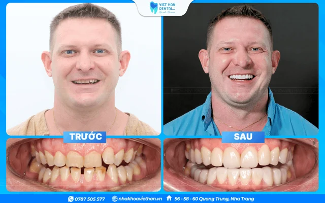 Hình ảnh khách hàng 1 của Bác sĩ Hoàng Thị Thảo Ngân