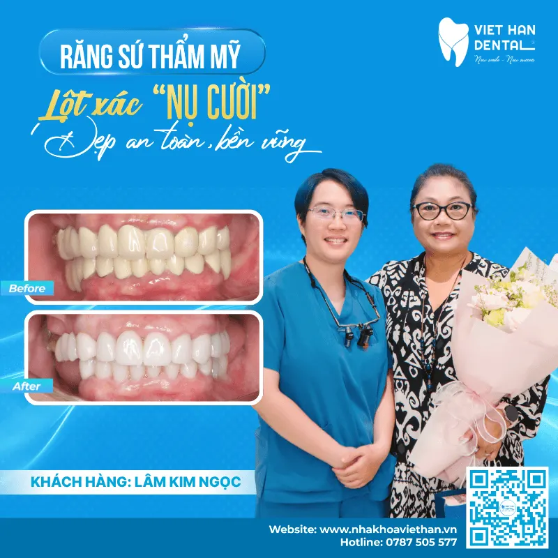 Kh Trước Sau Có Thông Tin (1)