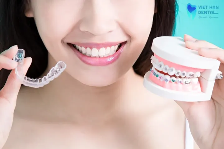 Đặc điểm và quy trình niềng răng Invisalign