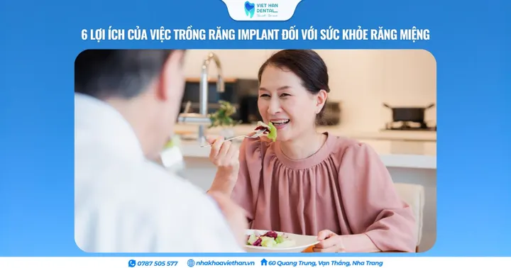 6 Lợi ích của việc trồng răng Implant đối với sức khỏe răng miệng