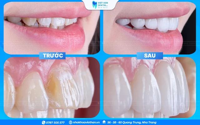 Hình ảnh khách hàng 4 của Bác sĩ Phạm Nhật Huy