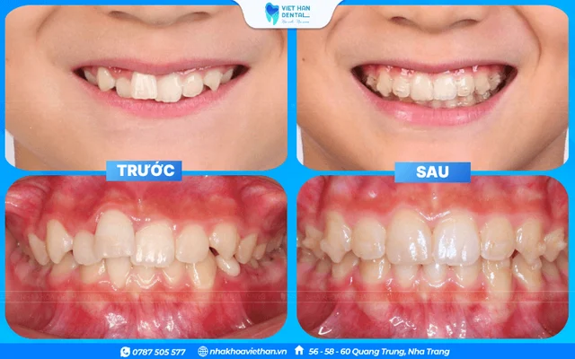 Hình ảnh khách hàng 4 của Bác sĩ Hoàng Thị Thảo Ngân