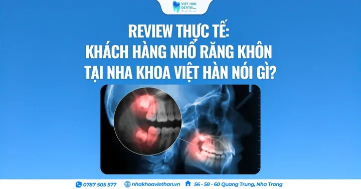 Review thực tế: Khách hàng nhổ răng khôn tại Nha khoa Việt Hàn nói gì?