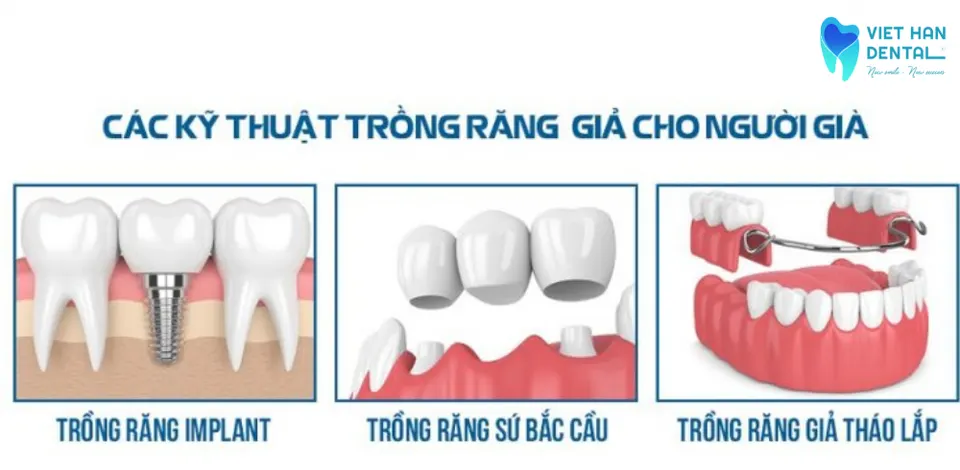 Nguoi Gia Nen Trong Rang Bang Phuong Phap Nao