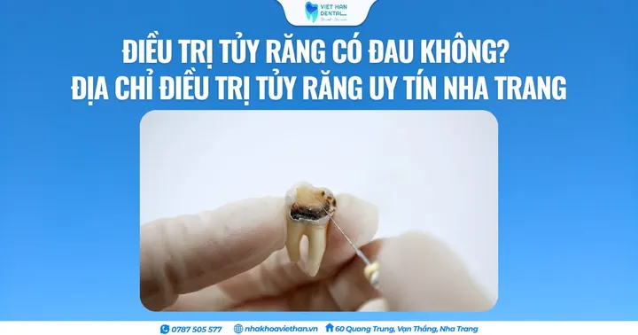 Điều trị tủy răng có đau không? Địa chỉ điều trị tủy răng uy tín tại Nha Trang