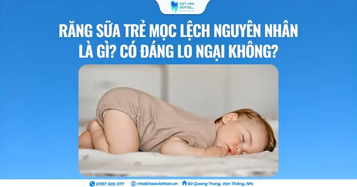 Răng sữa trẻ mọc lệch nguyên nhân là gì? Có đáng lo ngại không?