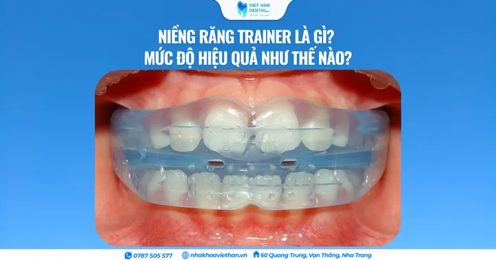 Niềng răng trainer là gì? Mức độ hiệu quả như thế nào?