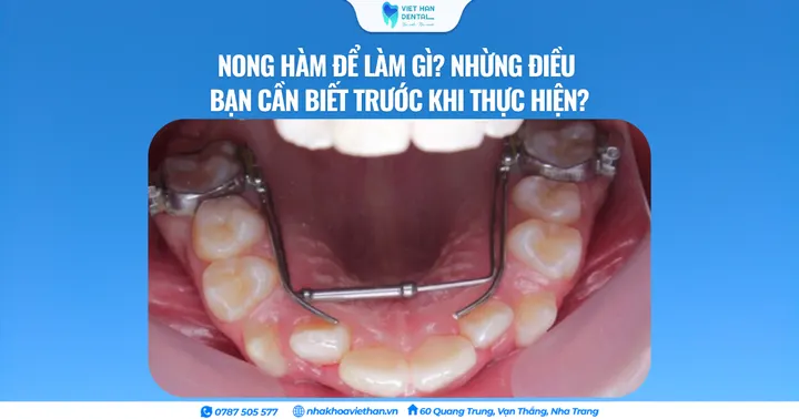 Nong hàm để làm gì? Nhừng điều bạn cần biết trước khi thực hiện?