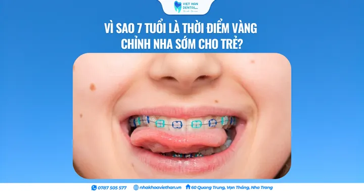 Vì sao 7 tuổi là thời điểm vàng chỉnh nha sớm cho trẻ?