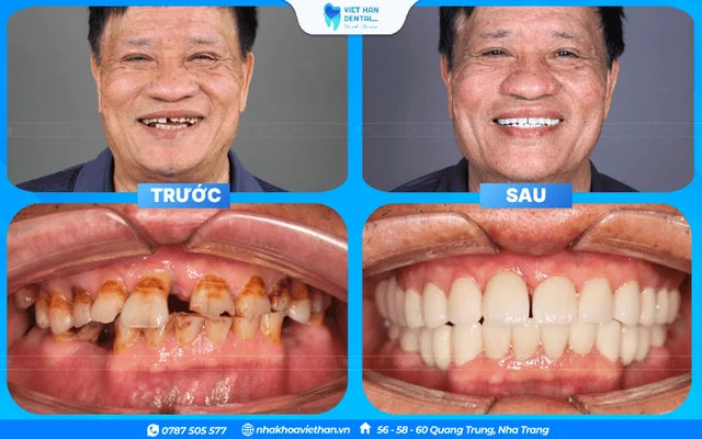 Hình ảnh khách hàng 3 của Bác sĩ Lê Châu Hưng Thịnh